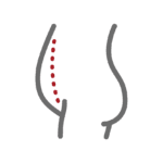 Droopy or loose skin