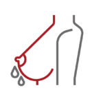 Leakage or rupture of an implant