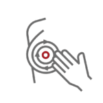 Rotation of a teardrop implant