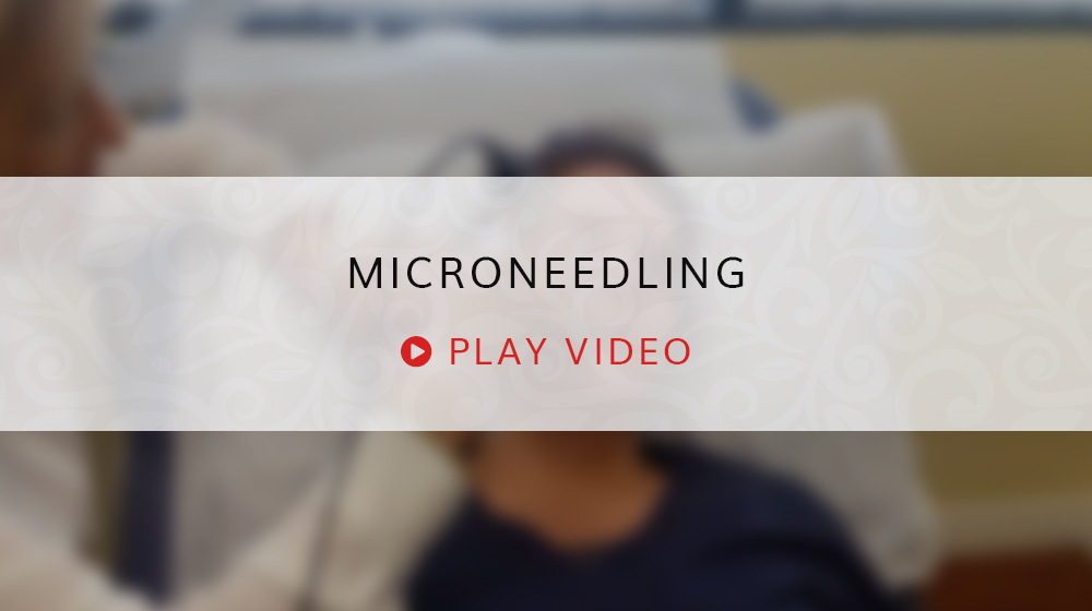 Microneedling Play Video Still